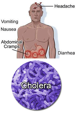 Cholera