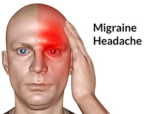 Migraine