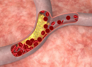 Cholesterol