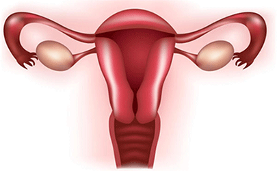 Dysfunctional Uterine Bleeding