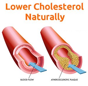 Lower Cholesterol