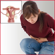 Uterine fibroids sign and Symptoms images