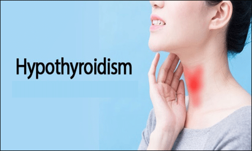 Hypothyroidism