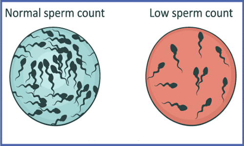 Oligospermia (Low-Sperm-Count)