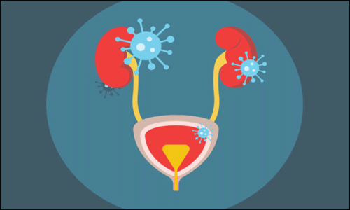 Urinary Tract Infection