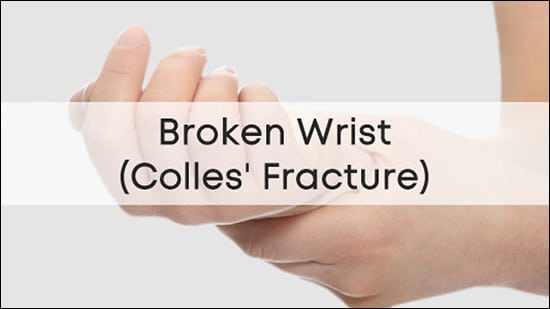 Colles fracture, Broken wrist