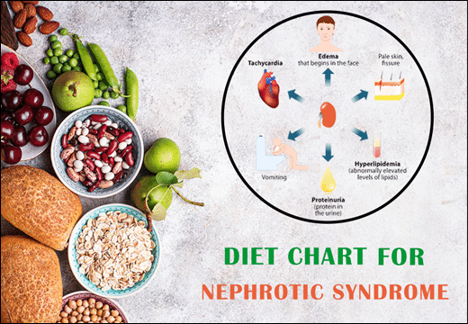 Nephrotic Syndrome, Diet Chart for Nephrotic Syndrome, Diet Plan for Nephrotic Syndrome, Nephrotic Syndrome Diet Chart, Rajamruth Vaidyashala Diet Chart, Diet For Nephrotic Syndrome, Nephrotic Syndrome Diet