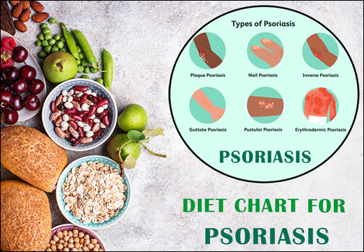 Psoriasis, Diet Chart for Psoriasis, Diet Plan for Psoriasis, Psoriasis Diet Chart, Psoriasis Diet Plan, Rajamruth Vaidyashala Diet Chart, Rajamruth Vaidyashala Diet Chart For Psoriasis