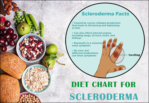 Scleroderma, Diet Chart for Scleroderma, Diet Plan for Scleroderma, Scleroderma Diet Chart, Scleroderma Diet Plan, Rajamruth Vaidyashala Diet Chart, Rajamruth Vaidyashala Diet Chart For Scleroderma, Diet Chart For Scleroderma Patient